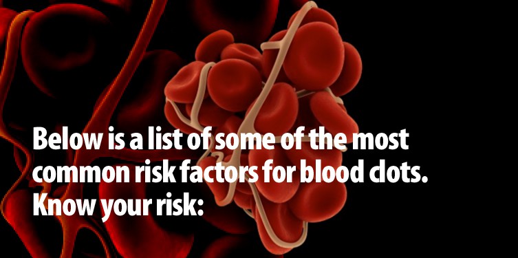 List-of-common-risk-factors-for-blood-clots.-Know-your-risk