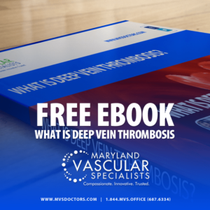 Free Ebook - What is deep vein thrombosis