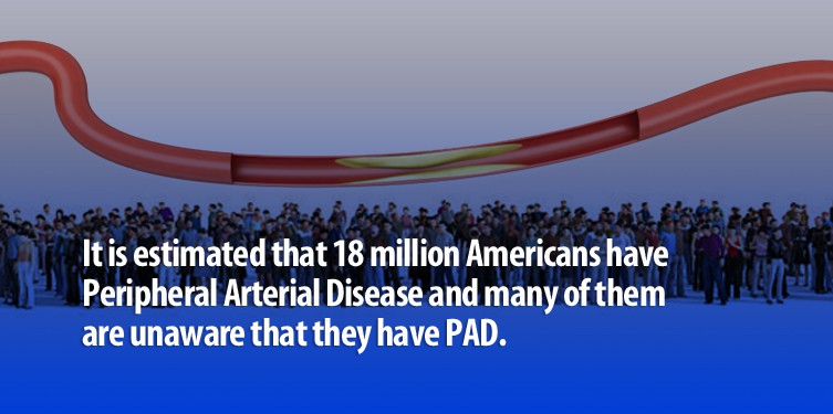 Peripheral-Artery-Disease-MD-DC-PA