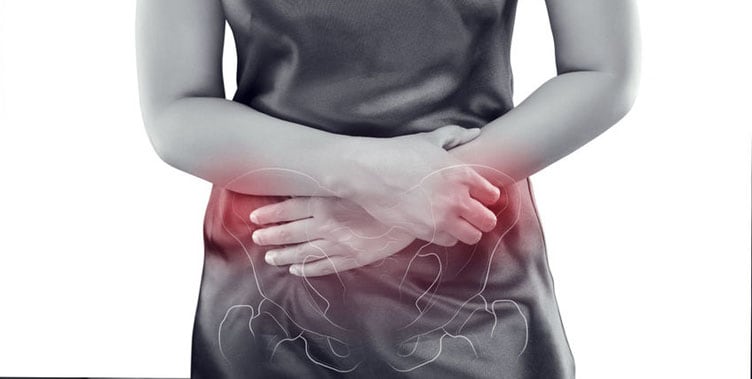 Pelvic Congestive Syndrome or PCS Could be the Cause of Your Pelvic Pain